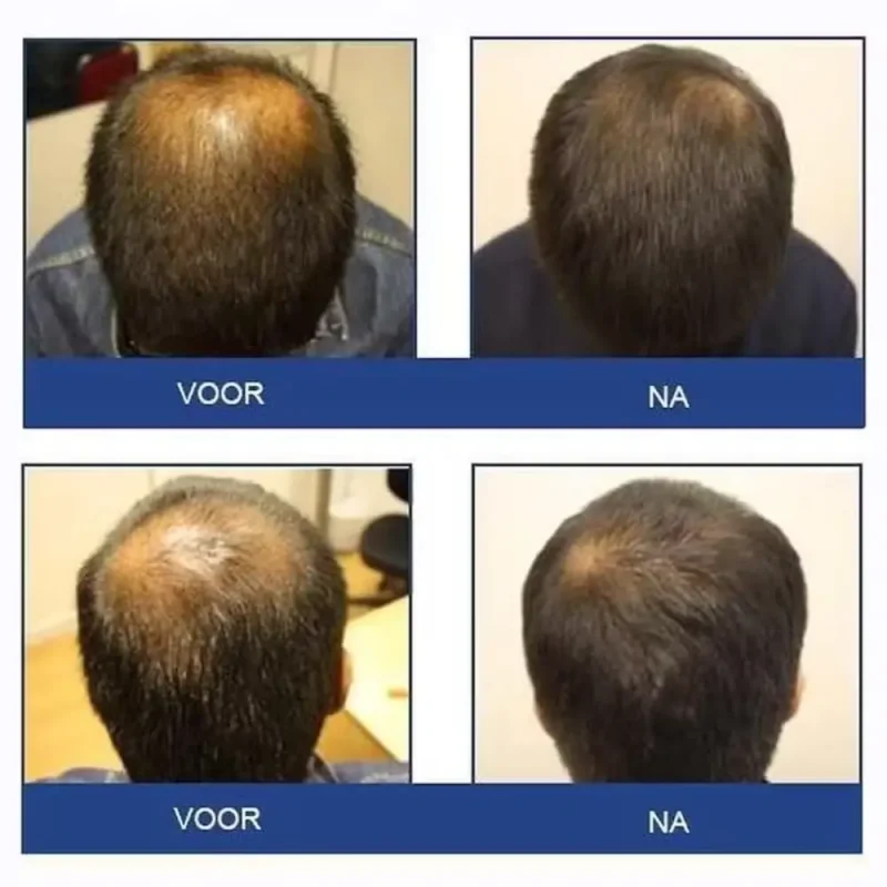 Foligain Triple Action Shampoo For Thinning Hair Men’s Volumizing Shampoo with 2% Trioxidil 8 Fl. Oz. - Image 4